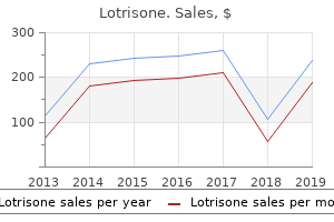 buy lotrisone cheap